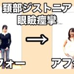 痙性斜頸　眼瞼痙攣　食いしばり　女性